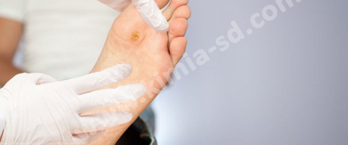 لطفا زخم دیابت نگیرید!!