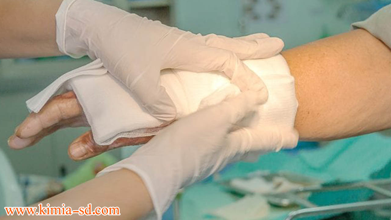 درمان التهاب ناشی از لیزر با پماد کیمیا - درمان زخم بستر